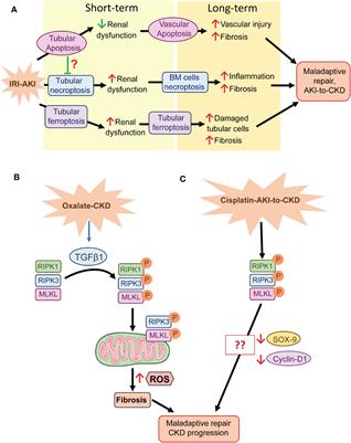 Regulated necrosis role in inflammation and repair in acute kidney injury